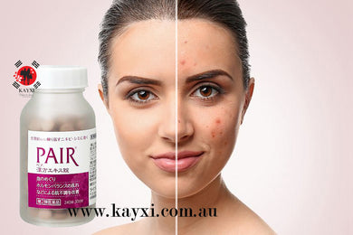 [LION] PAIR Kampo Women Herbal Medicine Hormone/Acne Treatment 240 Tablets