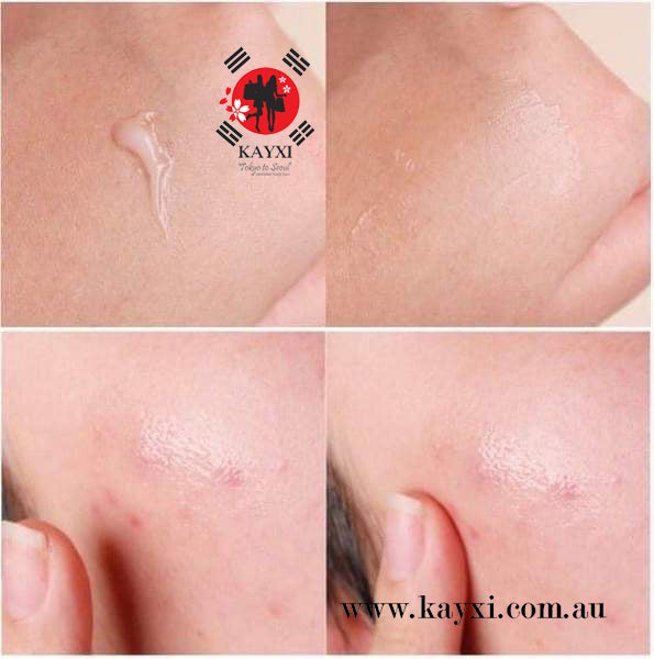 [Dong-A Pharmaceutical] Noscarna  Acne Treatment Gel 10g