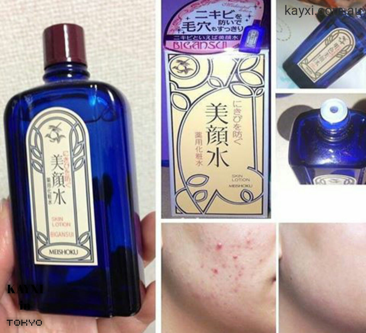 [MEISHOKU] Skin Lotion (No More Acne!) 80ml