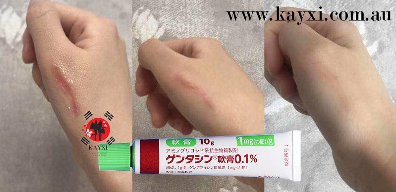[MSD/TAKATA SEIYAKU] Gentacin Scar Removal Ointment 10g