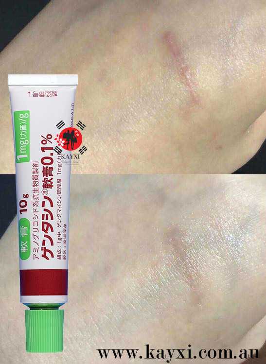 [MSD/TAKATA SEIYAKU] Gentacin Scar Removal Ointment 10g