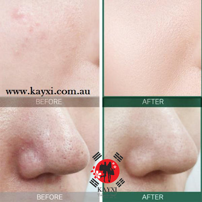 [SOME BY MI] AHA, BHA, PHA 30 Days  Miracle Serum 50ml