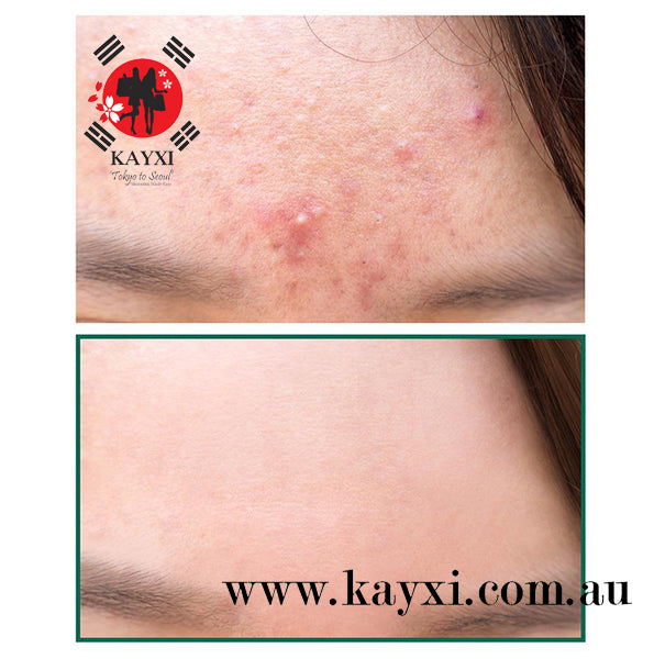 [SOME BY MI] AHA, BHA, PHA 30 Days  Miracle Serum 50ml