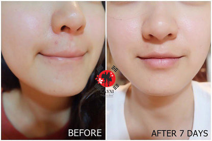 [ANGEL’S LIQUID] Glutathione Ever Collagen 35 Tablets Limited Edition