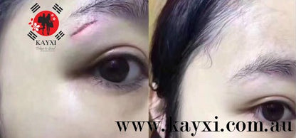 [MSD/TAKATA SEIYAKU] Gentacin Scar Removal Ointment 10g