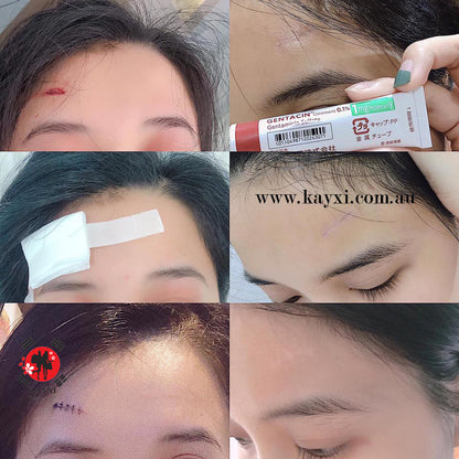 [MSD/TAKATA SEIYAKU] Gentacin Scar Removal Ointment 10g