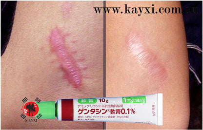 [MSD/TAKATA SEIYAKU] Gentacin Scar Removal Ointment 10g