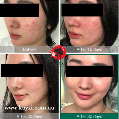 [SOME BY MI] AHA, BHA, PHA 30 Days  Miracle Cream 50ml